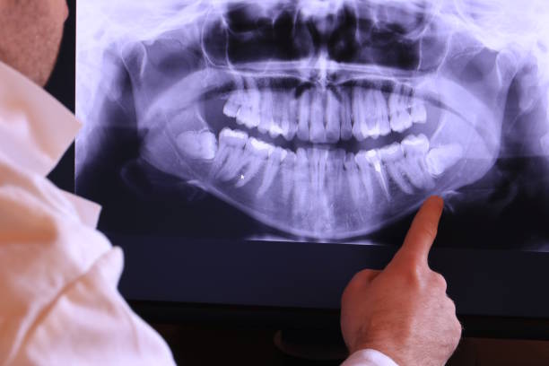 Best Cracked Tooth Emergency Dentist  in Fraser, MI